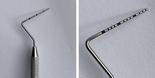 A UNC 15 calibrated periodontal probe, with tip detail